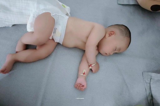 福鼎宝宝头上长痱子